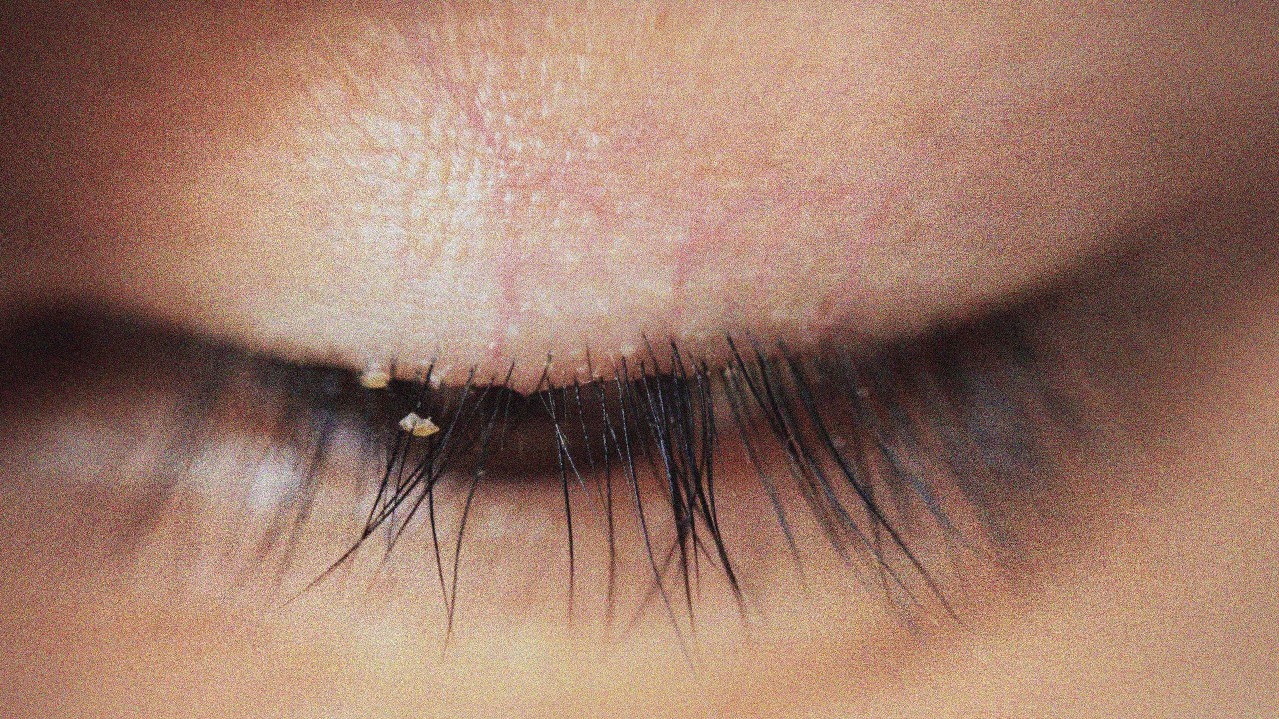 Close up of eye mites