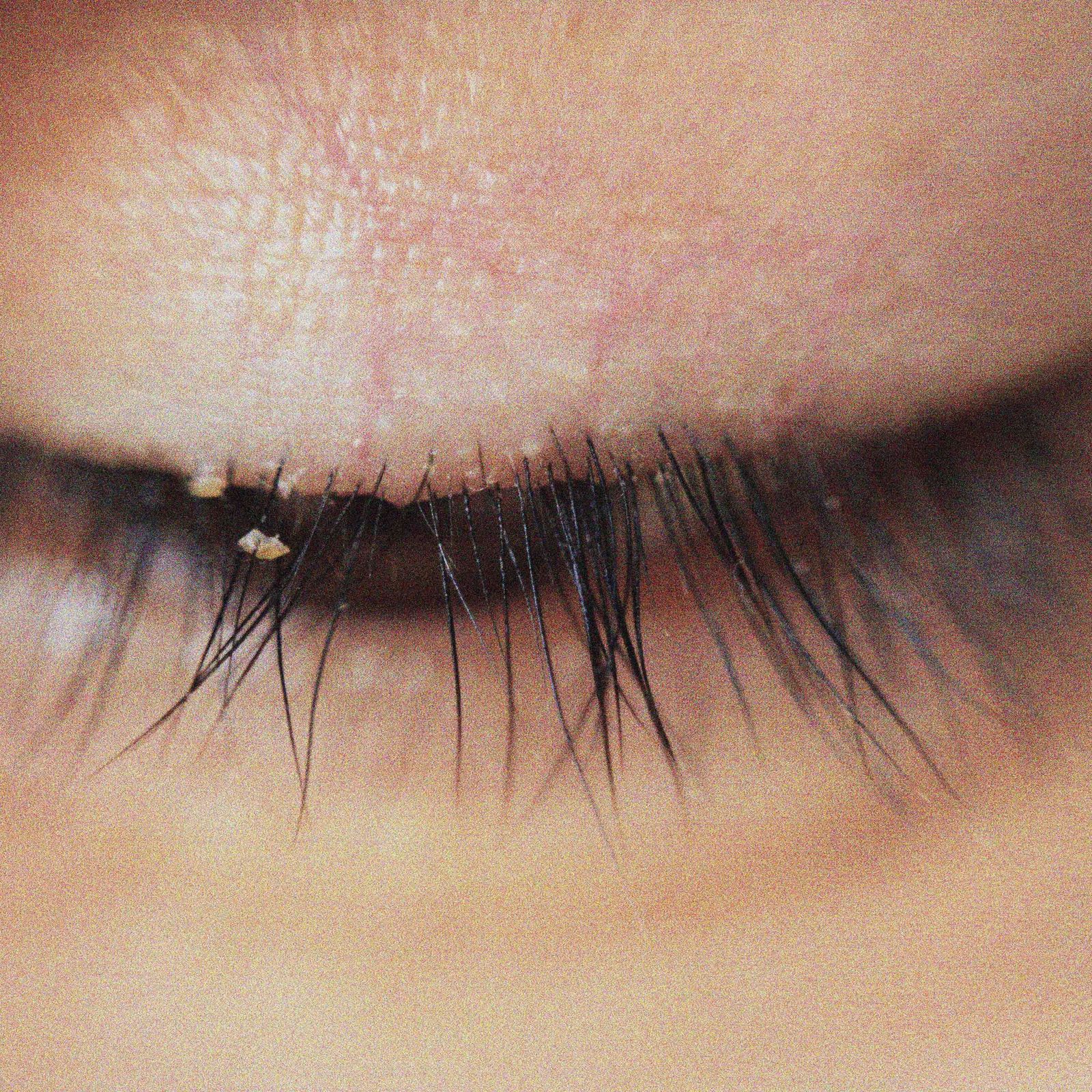 Irritated Eyes? Tiny Mites Living in Your Lashes Could Be Why