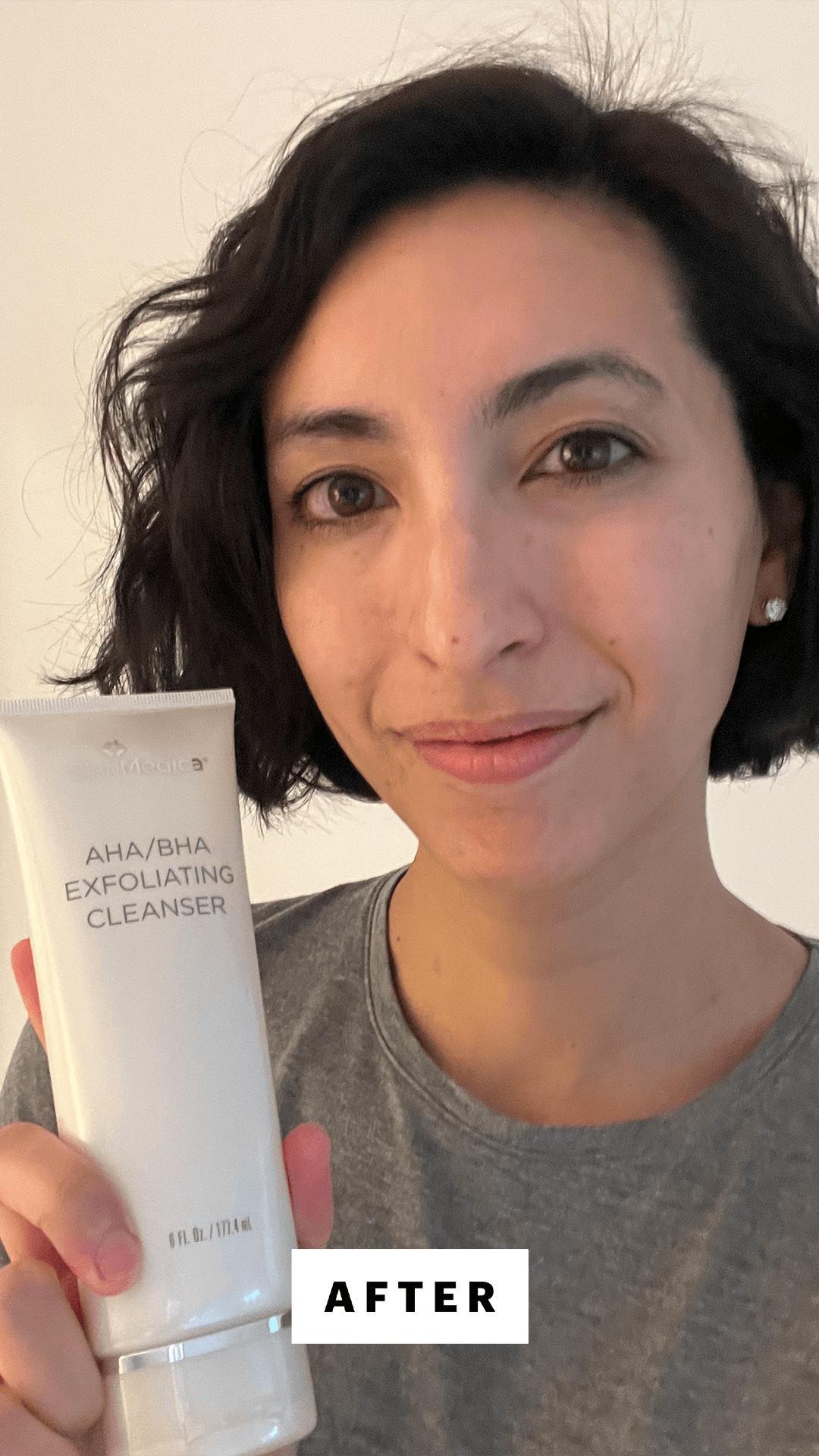 Pai after applying SkinMedica's AHA BHA Exfoliating Cleanser